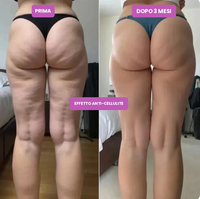 LEG-FIT™ 3D — GAMBE TONICHE. ADDIO CELLULITE.