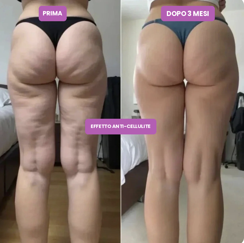 LEG-FIT™ 3D — GAMBE TONICHE. ADDIO CELLULITE.